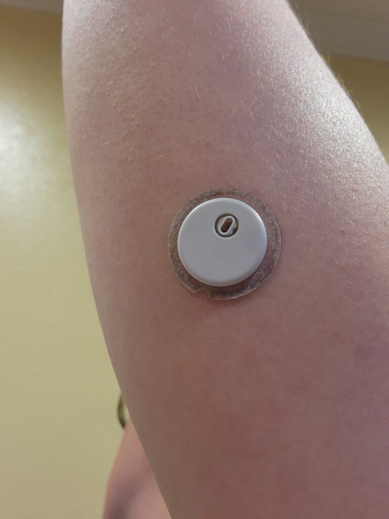 Comparing CGMs – Dexcom G7 vs FreeStyle Libre 3